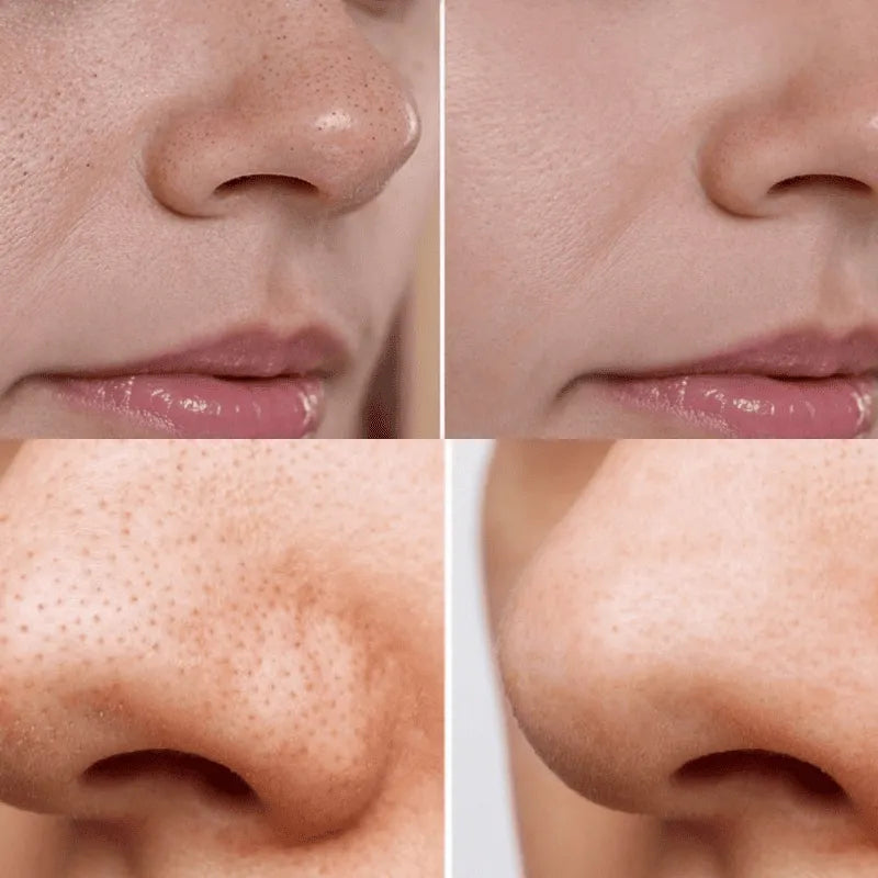 Anua Heartleaf - Control de Poros, Normaliza Tu Piel + Serum Gratis