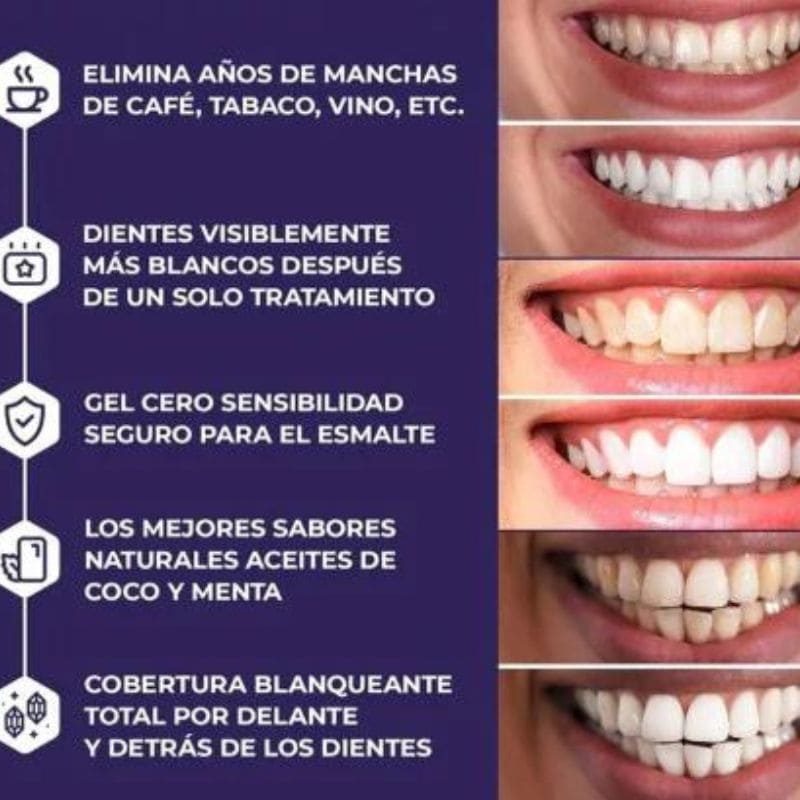 Smile White - Blanqueamiento profundo Profesional PAGA 1 LLEVA 2